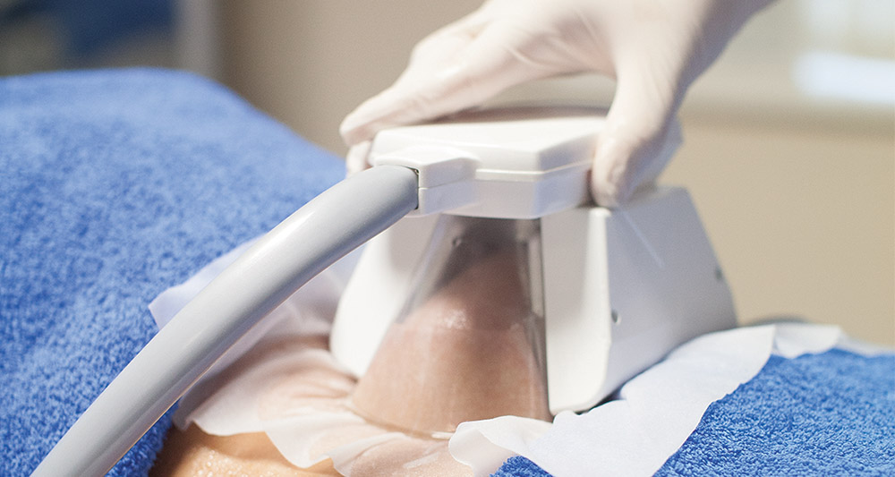 Multiple Areas in One Session HIFU and Fat Freezing West Bromwich