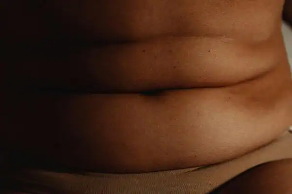 The Hidden Connection: How Stress Shapes Your Fitness and Body Composition 3 image of what stress can do on the stomach area and how Lipo 360 West Bromwich can help to change your body shape.