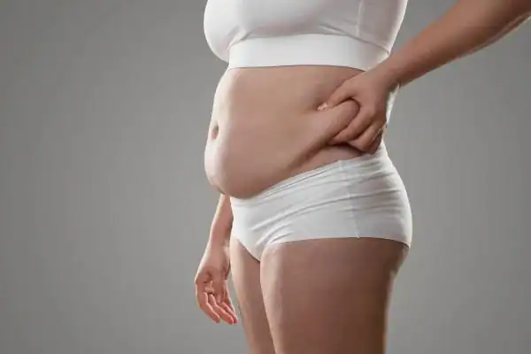 Image of stress belly West Bromwich How Lipo 360 can help manage your symptoms